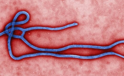 Congo Ebola Outbreak - Bundibugyo Ebola virus virion microscopic image
