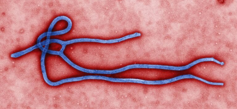 Congo Ebola Outbreak - Bundibugyo Ebola virus virion microscopic image